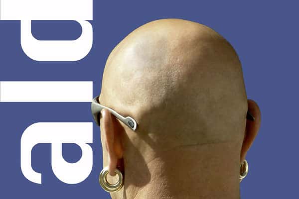 Эксперт рассказала почему выпадают волосы