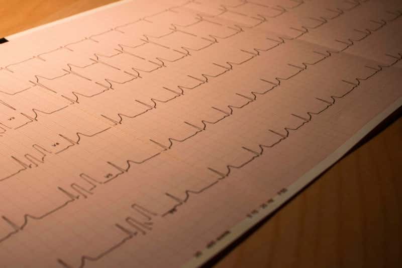 Врач рассказала, как питаться людям с сердечно-сосудистыми заболеваниями