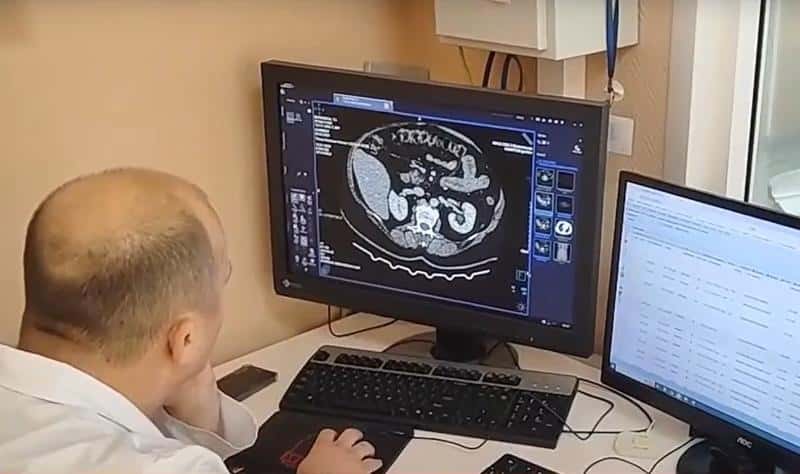 За год ИИ обработал более миллиона рентгенов грудной клетки в Свердловской области  