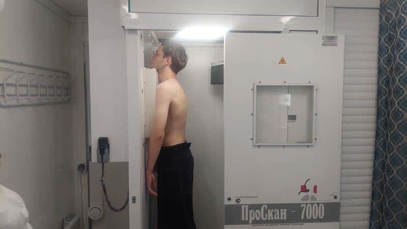 В Первоуральске усиливают борьбу с туберкулезом: обследовано 113 тысяч человек