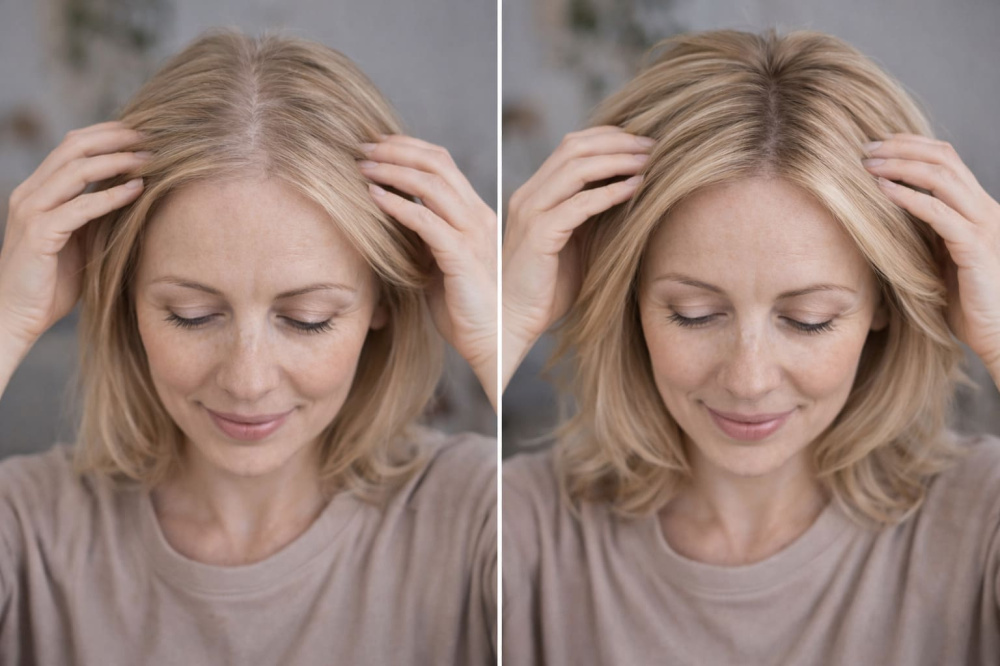 Можно ли сделать волосы гуще после 50: мнение трихологов и реальные методы | Как улучшить густоту волос после 50 лет