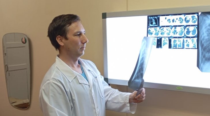 Свердловские врачи спасли 23-летнюю пациентку с тяжелой формой туберкулеза | На Урале врачи спасли девушку с казеозной пневмонией 