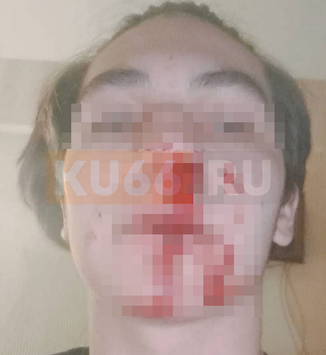 В Каменске-Уральском жестоко избит подросток | На Урале жестоко избит подросток В Каменске-Уральском жестоко избит подросток | На Урале жестоко избит подросток